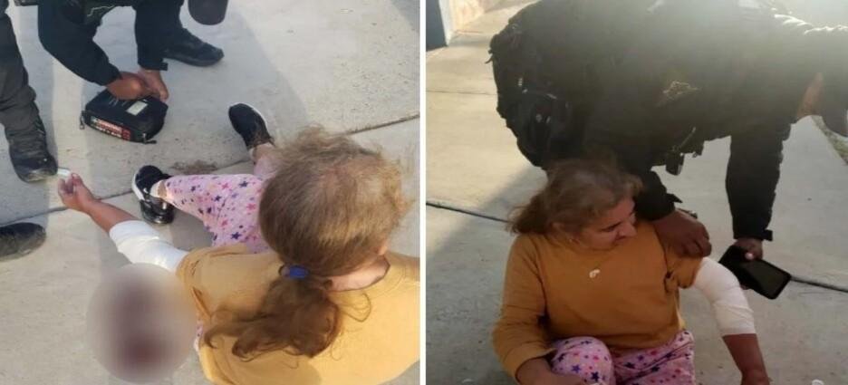 Mujer adulto mayor fueatacada por dos Pitbull
