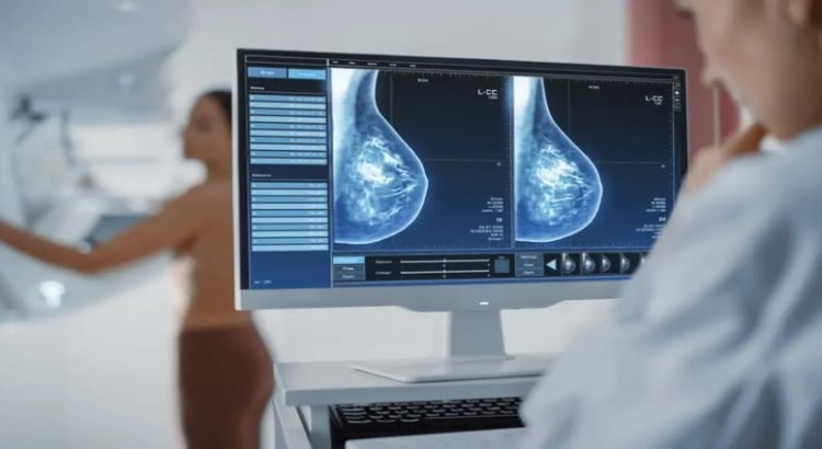 Anuncian pruebas gratuitas de detección de cáncer de mama y cervicouterino en Tijuana